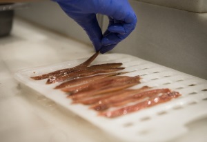 La anchoa de Santoña: tu aliado perfecto para llevar una dieta equilibrada 